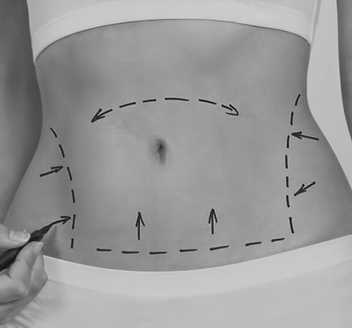 karın-germe karın-germe